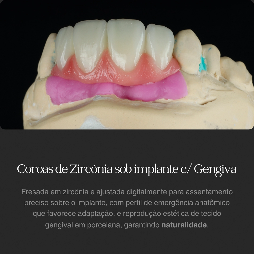 CoroaZirconiaSobImplante